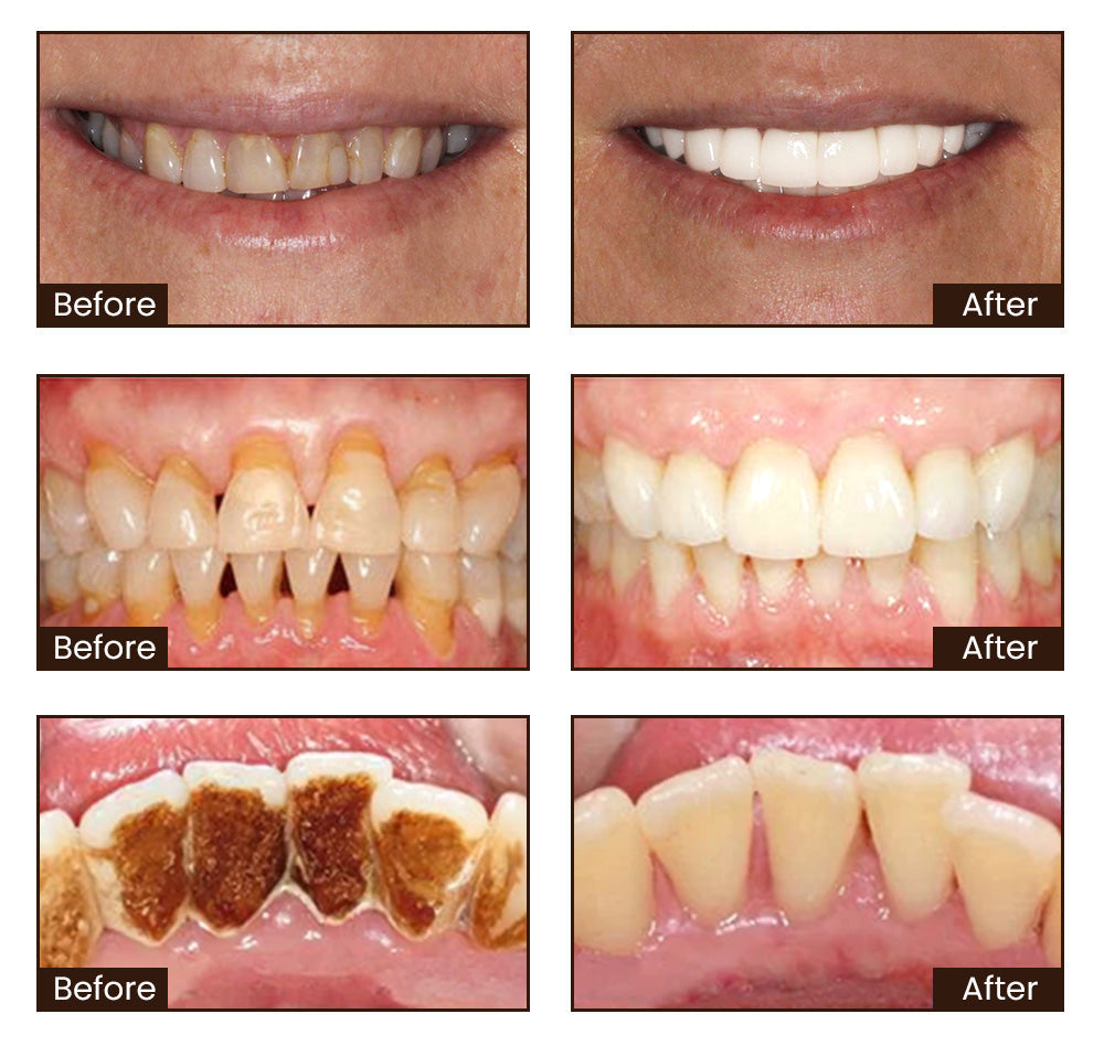 š„Limited Stock āNiacinamide Whitening Toothpaste