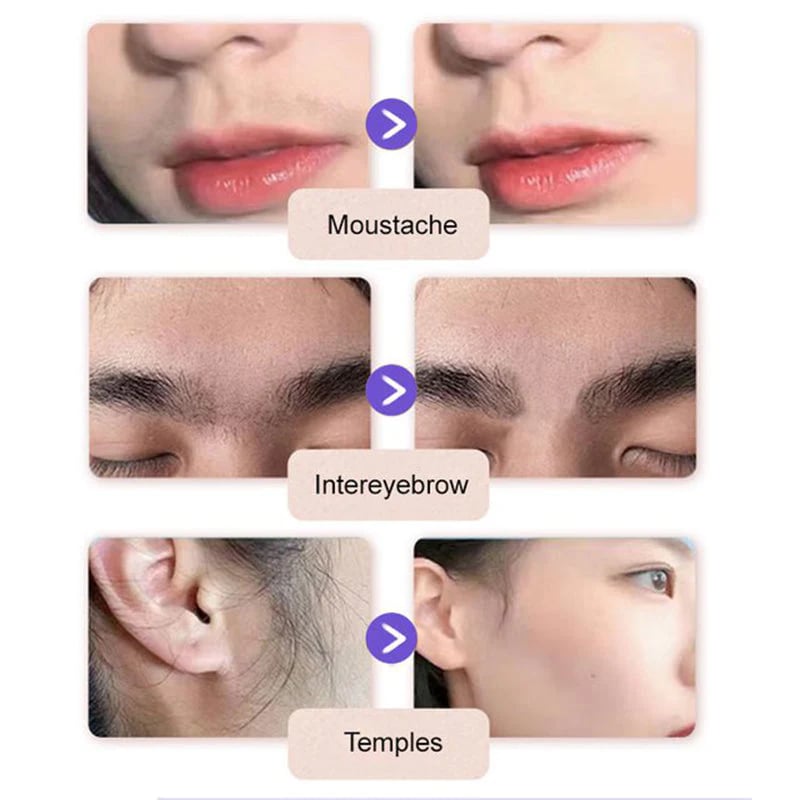🔥 Today!-Buy 2 Get 1 FREE🔥Gentle and Painless Facial Hair Removal Cream