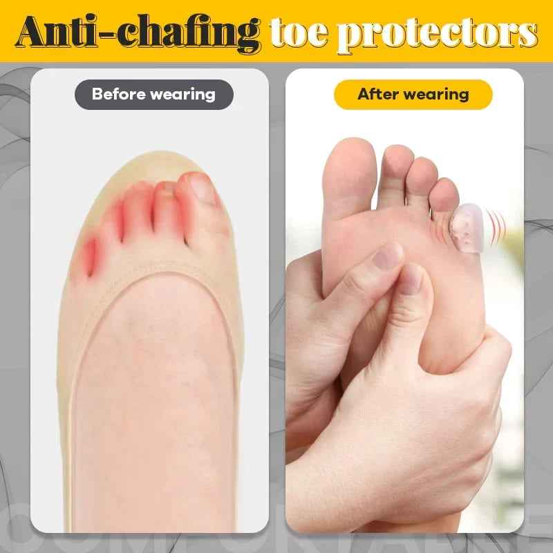 🔥Silicone anti-friction toe protector