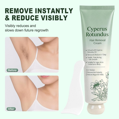 ✨LAST DAY -BUY 1 GET 1 FREE🤩  Ahlwo Painless Depilatory Cream – No Razor Bumps, No Harsh Odor